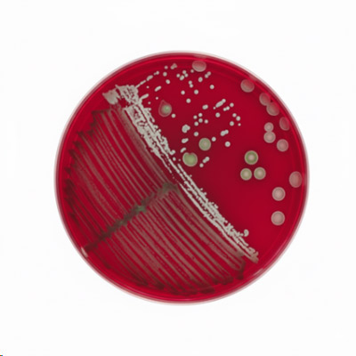 تفاوت محیط کشت انتخابی و افتراقی