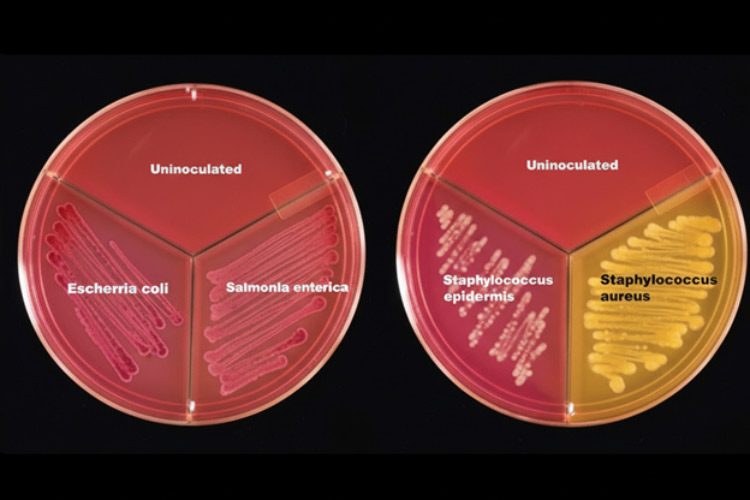 تفاوت محیط کشت انتخابی و افتراقی