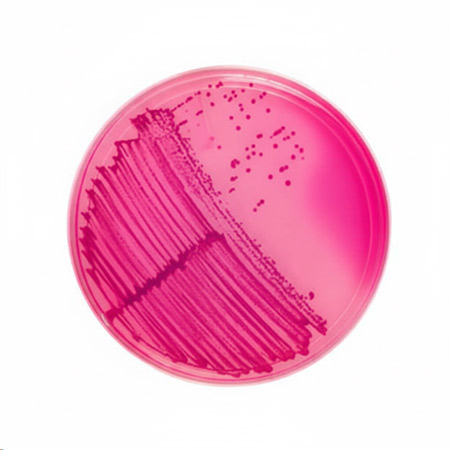 تفاوت محیط کشت انتخابی و افتراقی