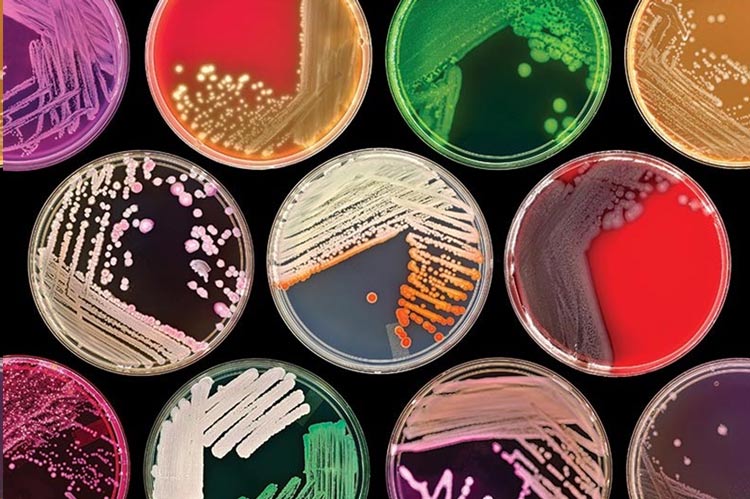 انواع محیط کشت