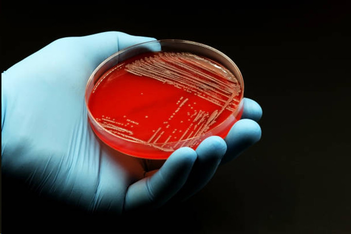 انواع محیط کشت