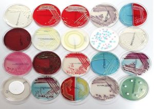 مقایسه انواع محیط کشت