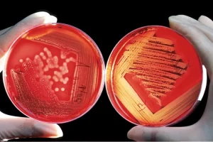 محیط کشت میکروبی