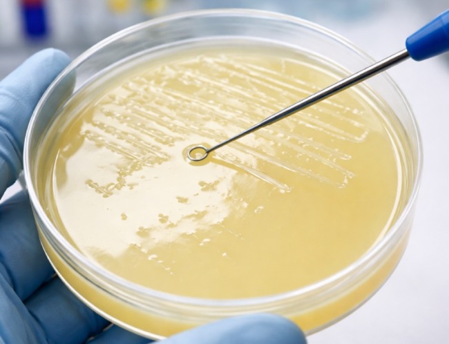 محیط کشت نیمه جامد