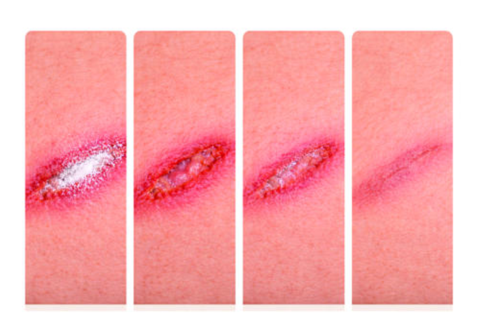 پودر ترمیم کننده زخم ۲