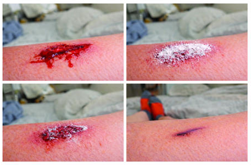 پودر بندآورنده خون 