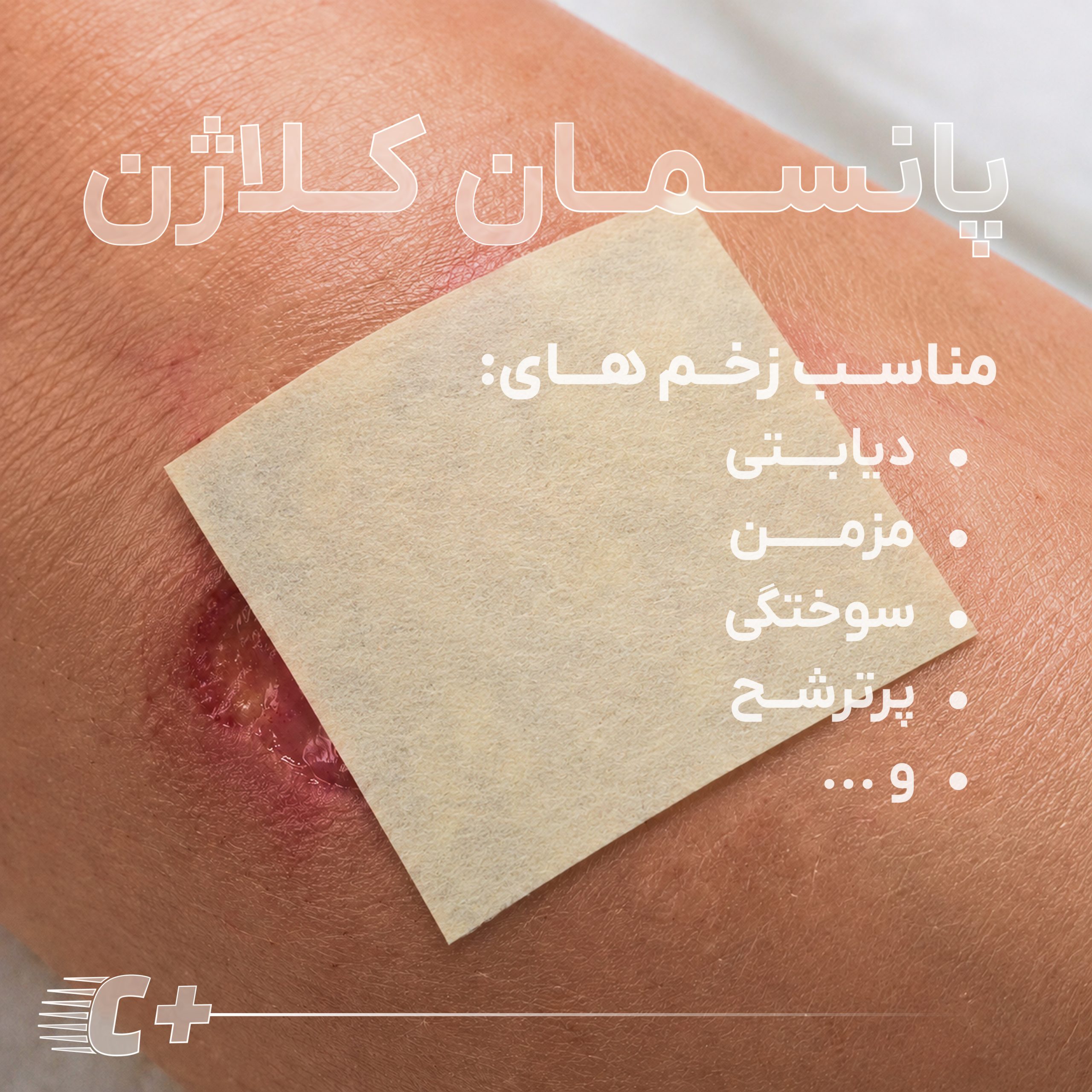 پانسمان کلاژن دار- پانسمان ترمیم زخم- پانسمان زخم دیابتی و زخم سوختگی